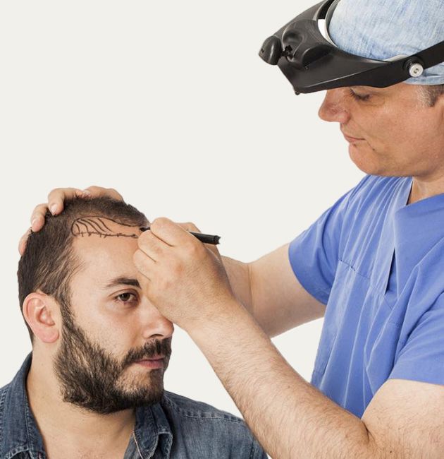 Hair Transplant